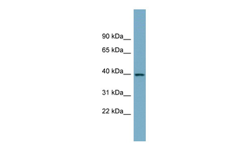 SULT2B1 Rabbit Polyclonal Antibody