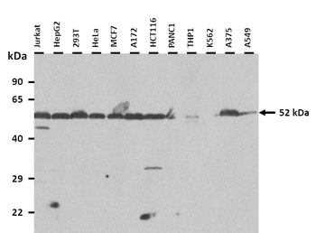 CDR2 Rabbit Polyclonal Antibody