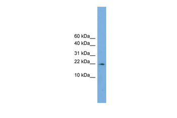 PPIL3 Rabbit Polyclonal Antibody