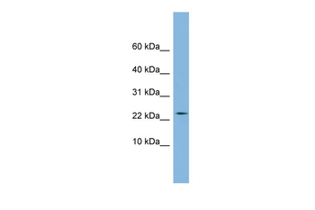 PPIL3 Rabbit Polyclonal Antibody