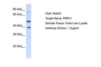 PRR11 Rabbit Polyclonal Antibody