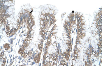 RSRC2 Rabbit Polyclonal Antibody