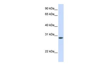 TNNT3 Rabbit Polyclonal Antibody