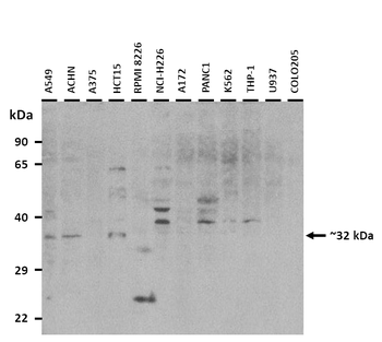 TNNT3 Rabbit Polyclonal Antibody