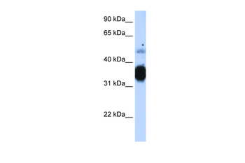 TNNT3 Rabbit Polyclonal Antibody