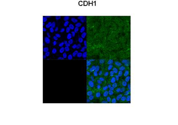 CDH1 Rabbit Polyclonal Antibody