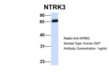 NTRK3 Rabbit Polyclonal Antibody