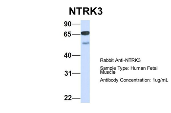 NTRK3 Rabbit Polyclonal Antibody