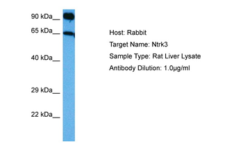 NTRK3 Rabbit Polyclonal Antibody