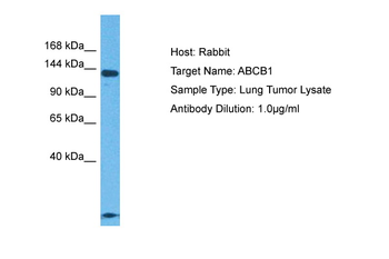 ABCB1 Rabbit Polyclonal Antibody