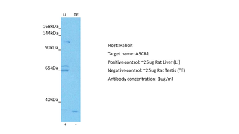 ABCB1 Rabbit Polyclonal Antibody