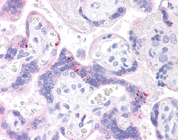 ABCB1 Rabbit Polyclonal Antibody