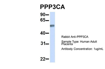 PPP3CA Rabbit Polyclonal Antibody