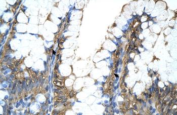PPIA Rabbit Polyclonal Antibody