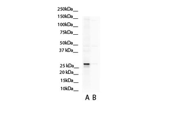 ASPH Rabbit Polyclonal Antibody