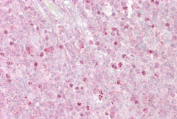 OAS1 Rabbit Polyclonal Antibody