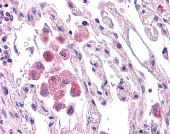 HNF1A Rabbit Polyclonal Antibody