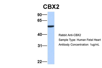 CBX2 Rabbit Polyclonal Antibody
