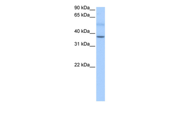 SERTAD2 Rabbit Polyclonal Antibody