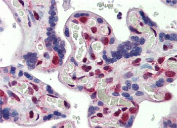 FUBP3 Rabbit Polyclonal Antibody