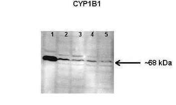 CYP1B1 Rabbit Polyclonal Antibody