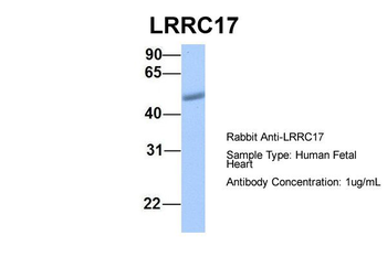 LRRC17 Rabbit Polyclonal Antibody