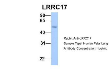 LRRC17 Rabbit Polyclonal Antibody
