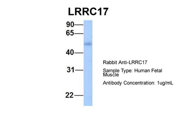LRRC17 Rabbit Polyclonal Antibody