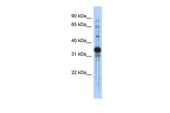CHAD Rabbit Polyclonal Antibody