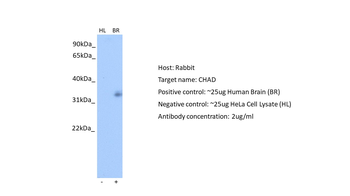 CHAD Rabbit Polyclonal Antibody