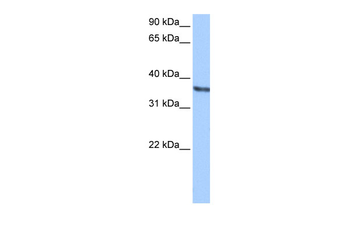 CHAD Rabbit Polyclonal Antibody