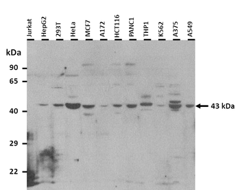 CHI3L1 Rabbit Polyclonal Antibody
