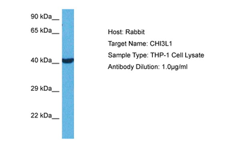 CHI3L1 Rabbit Polyclonal Antibody