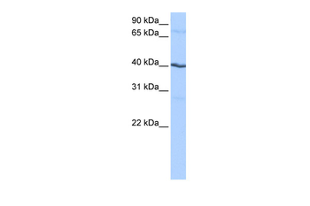 CSNK1G2 Rabbit Polyclonal Antibody