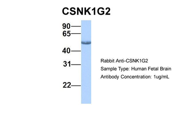 CSNK1G2 Rabbit Polyclonal Antibody