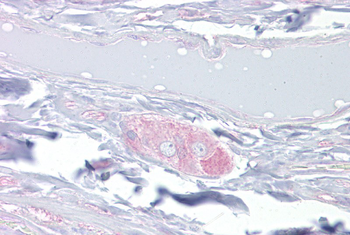 DPYSL3 Rabbit Polyclonal Antibody