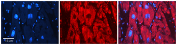 EIF2B1 Rabbit Polyclonal Antibody