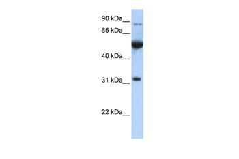 EIF2B1 Rabbit Polyclonal Antibody