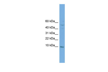 COX7B Rabbit Polyclonal Antibody