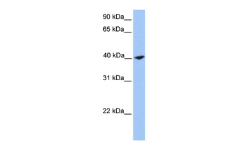 CNN2 Rabbit Polyclonal Antibody