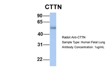 CTTN Rabbit Polyclonal Antibody