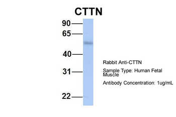 CTTN Rabbit Polyclonal Antibody