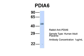 PDIA6 Rabbit Polyclonal Antibody