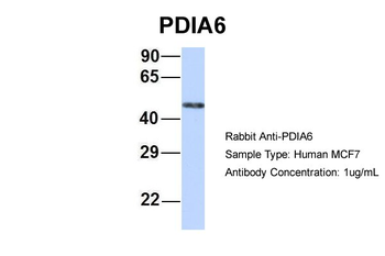 PDIA6 Rabbit Polyclonal Antibody
