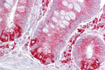 PDIA6 Rabbit Polyclonal Antibody