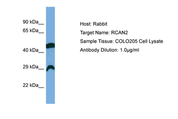 RCAN2 Rabbit Polyclonal Antibody