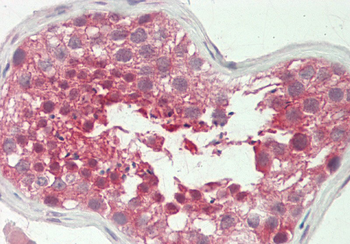 BCKDK Rabbit Polyclonal Antibody