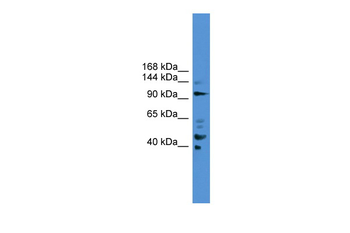 PIBF1 Rabbit Polyclonal Antibody