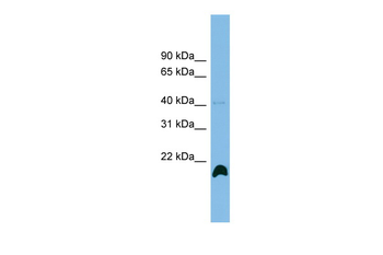 PPIH Rabbit Polyclonal Antibody