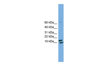 PPIH Rabbit Polyclonal Antibody